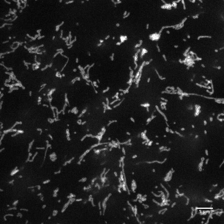 [object Object] thumbnail