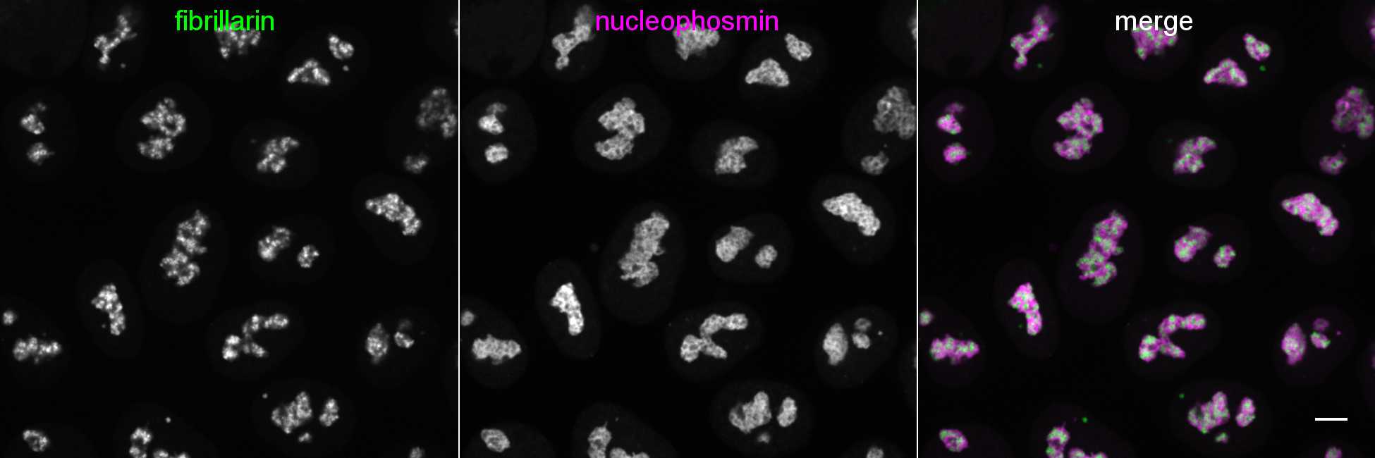 [object Object] thumbnail